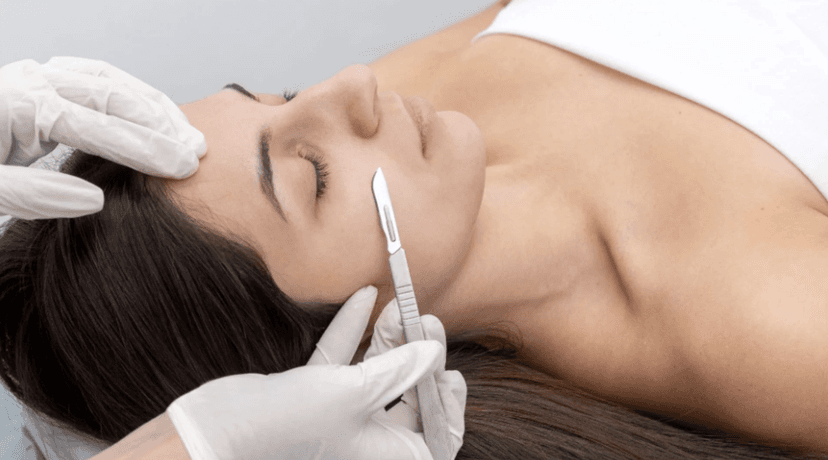 Dermaplaning